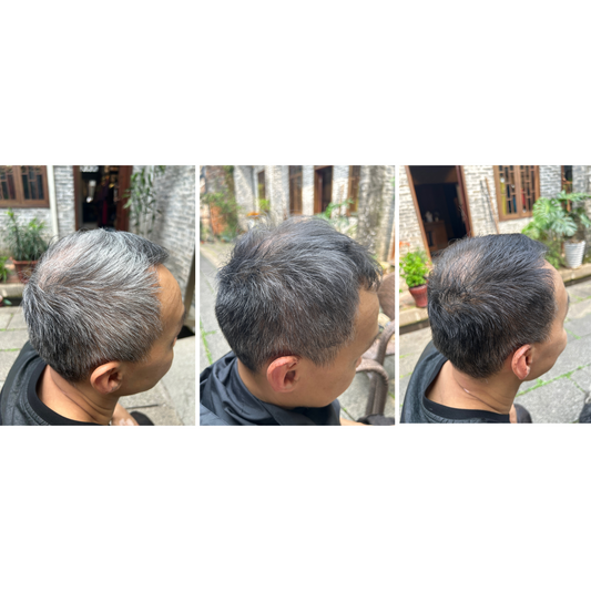 The Solution for Managing Gray Hair